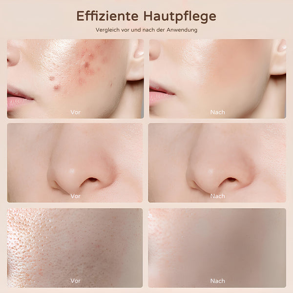 Before and after close-up of nose pores after using COOL-i LED light therapy mask